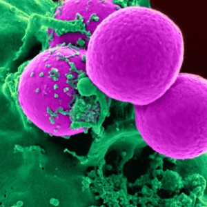 Detección de enterococos, Legionella y Pseudomona aeruginosa